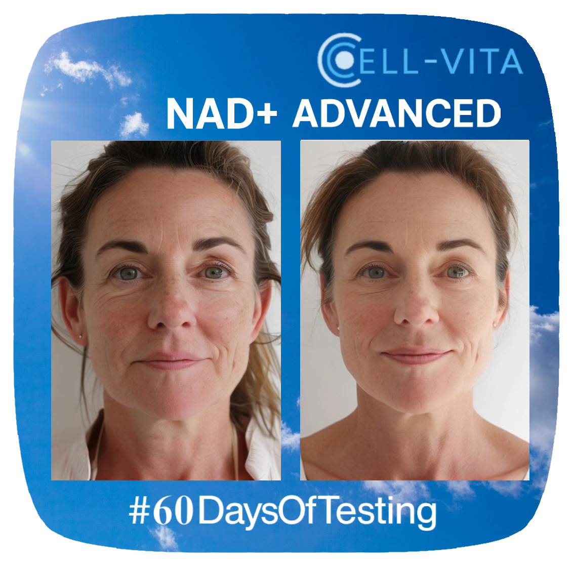 Cell-Vita NAD+ Advanced -  Life Supplement  - 60 Capsules